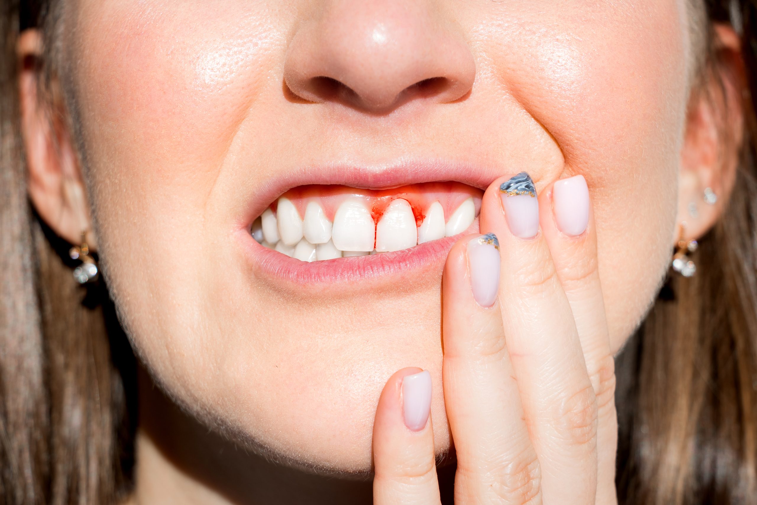 Understanding Gum (Periodontal) Disease Understanding Gum (Periodontal) Disease
